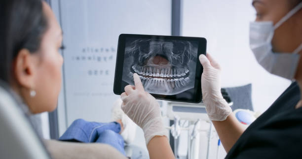 Licensed Dental Veneers service in Stark County County, ND - Smile Center Dentistry